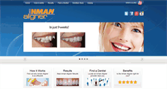 Desktop Screenshot of inmanaligner.com